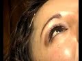 Contrastes - Reportaje: Medicina complementaria en Arequipa