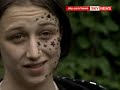 Face Tattoo Horror: Teenager Left Seeing Stars