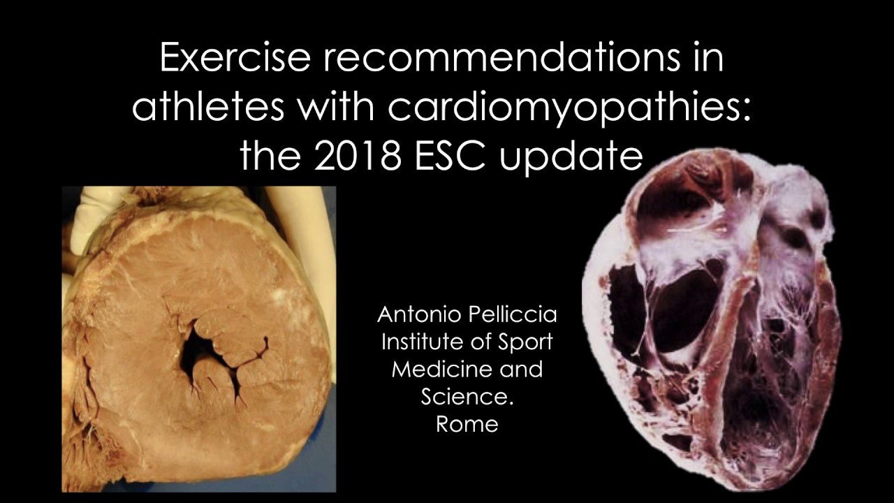 Recommended Exercise in Athletes with Cardiomyopathies - Dr Antonio Pelliccia