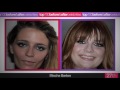Top 100: Before and After Celebrities (video) http://youtu.be/GSSKY62pv2I