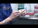 Teeth Whitening : Dental Braces: Canker Sores