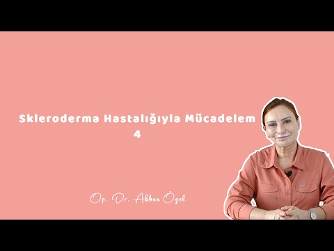 Skleroderma Hastalığıyla Mücadelem 4 - Op. Dr. Akben Özel - 2021.02.03