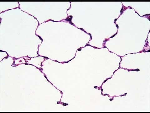 tissue - A short video about connective tissue, fibers and ground substance. Please see disclaimer on my website www.my-uni.net.