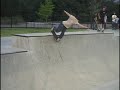 Backlip Allen