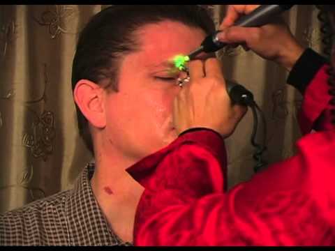 how to treat bell's palsy