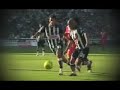 Suazo Total 90 Laser II - Deja todo