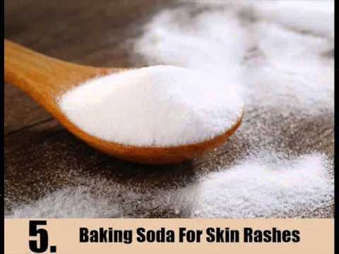 how to cure rash on face