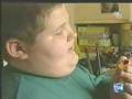 obesidad infantil 2