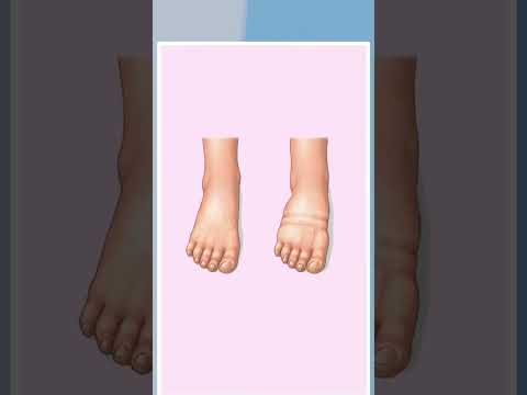 ?????????? ?? ???? ??????????? ??? ???? ???? ???