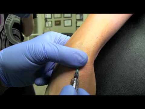 how to fit an iv drip