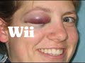 Nintendo Wii SYSTEM review pt1