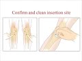 EZ-IO Intraosseous cannulation EZ-IO Intraosseous cannulation