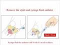 EZ-IO Intraosseous cannulation