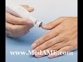 Access Diabetic Supplies Diabetes Feet Treatment