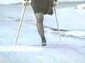 One-legged female street crutching