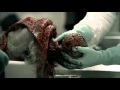 Saw 4 Parte 1-ITA