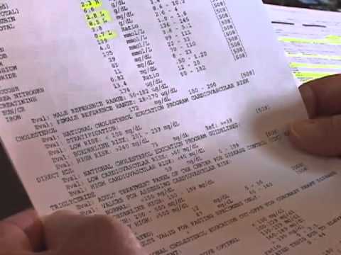 how to read lab results