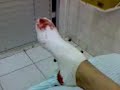 ai meu joelho!!! ai meu joelho!!!