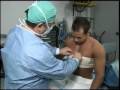 Gynecomastia Gynecomastia