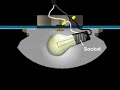 Wiring in a light fixture--basic summary Wiring in a light fixture--basic summary