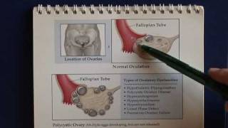 What are some common ovulatory problems? (video)