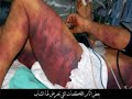 Torture au palestine