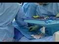 Better Treatment of Severe Blood Loss