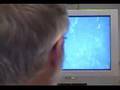 LASIK Blade Leaves Metal in Patient's Eye