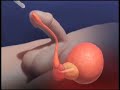 Urethral-Catheter-Pr