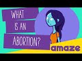 What is an abortion?