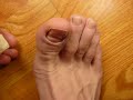 toe inspection inside and out, not amputation, clean fun