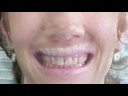 LVI Smile Cosmetic Dentists 4