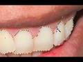 Brighten Teeth in Photoshop!