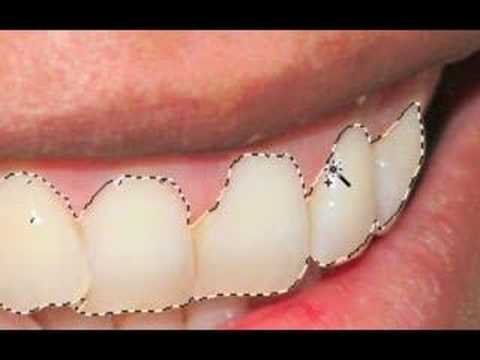 how to whiten teeth in photoshop cs3
