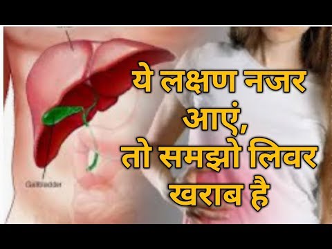लीवर खराब होने के लक्षण |sign of Liver damage in Hindi |Liver m khrab hone k kya lashn h|By Nida Ali