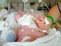 In Memory of Baby Landon Tyler for CDH and CHD, Rest in Peace Sweet Angel