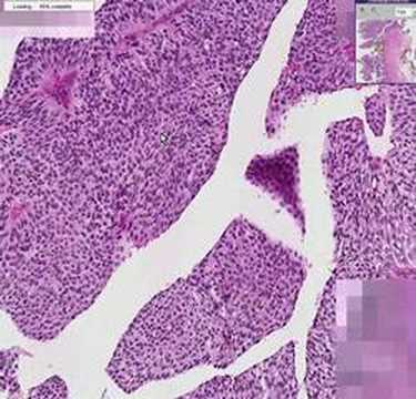Histopathology Ureter--Transitional ...