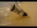 EM Procedures - Central Line part 4