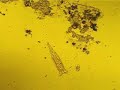Rotifer and amoebae
