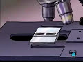 PreOp® Patient Education: Dilation and Curettage D and C pt2