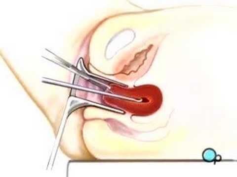 how to perform a d&c