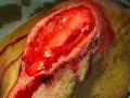 canine medial patellar luxation surgery