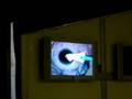 My Lasik Surgery pt.1
