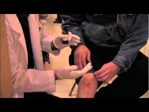 how to not itch eczema