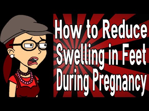 how to relieve oedema during pregnancy