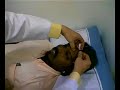 Bell Palsy Cure Bell Palsy Cure