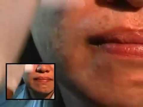 Malaysia - Worm inside your face