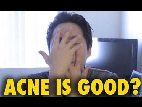 ACNE IS GOOD?! vlog