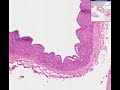 Histopathology Coronary arteries--Atherosclerosis
