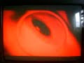 Dead Set- Teaser, During Big Brother 9 Live Feed